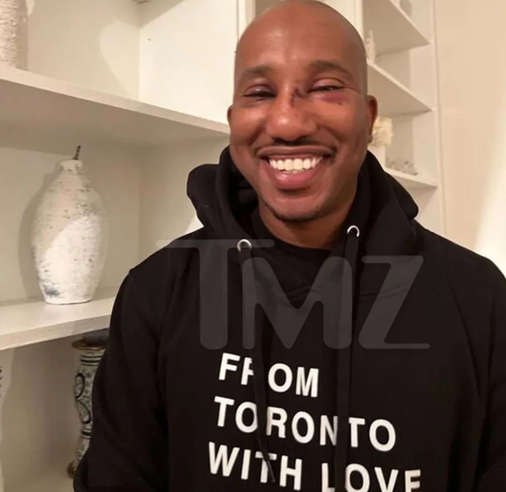 'SNL' alum Chris Redd is smiling through the pain after being attacked in New York City ... his nose is stitched up and his eyes are swollen and bruised.
